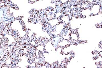 Immunohistochemistry-Paraffin: PDCD4 Antibody (3A8V10) [NBP3-16744]