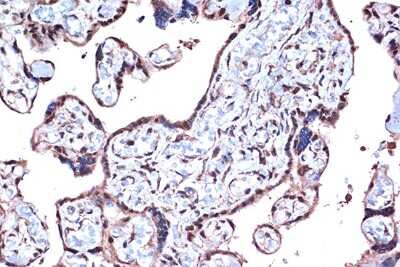 Immunohistochemistry-Paraffin: PDCD4 Antibody (3A8V10) [NBP3-16744]