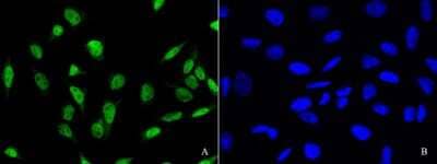 Immunocytochemistry/ Immunofluorescence: PDCD4 Antibody [NBP2-98857]