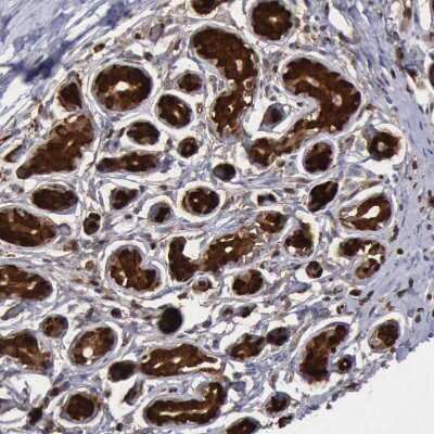 Immunohistochemistry-Paraffin: PDCD4 Antibody [NBP1-83302]