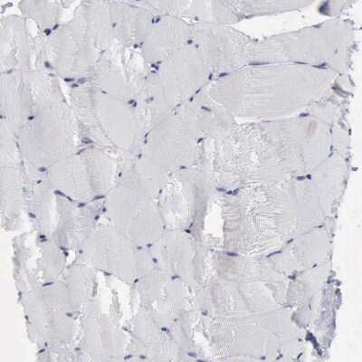 Immunohistochemistry-Paraffin: PDCD4 Antibody [NBP1-83302]