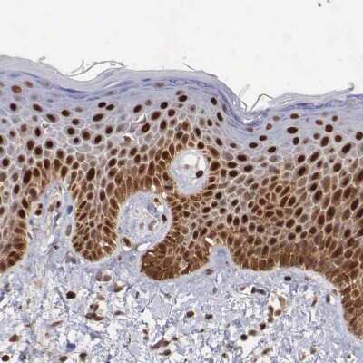 Immunohistochemistry-Paraffin: PDCD4 Antibody [NBP1-83302]