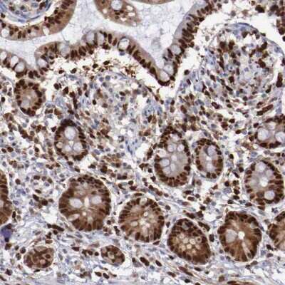 Immunohistochemistry-Paraffin: PDCD4 Antibody [NBP1-83302]