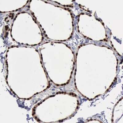 Immunohistochemistry-Paraffin: PDCD4 Antibody [NBP1-83302]