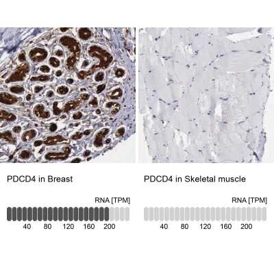 Immunohistochemistry-Paraffin: PDCD4 Antibody [NBP1-83302]