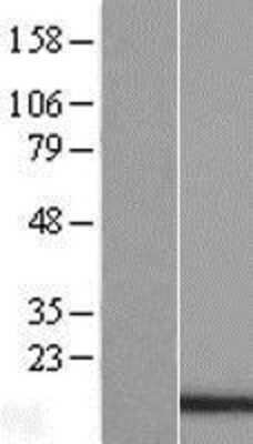 Western Blot: PDCD5 Overexpression Lysate [NBL1-14208]