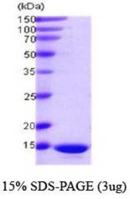 SDS-PAGE: Recombinant Human PDCD5 Protein [NBC1-18510]