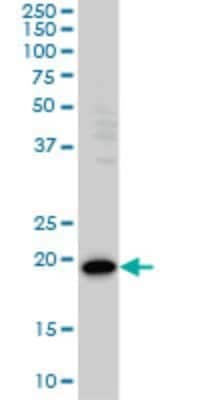 Western Blot: PDCD6 Antibody (2B4) [H00010016-M01]