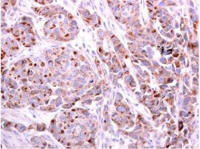 Immunohistochemistry-Paraffin: PDCD6 Antibody [NBP2-19741]