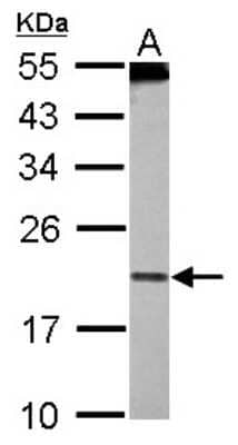 Western Blot: PDCD6 Antibody [NBP2-19741]