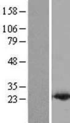 Western Blot: PDCD6 Overexpression Lysate [NBL1-14209]