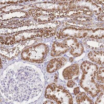 Immunohistochemistry-Paraffin: PDCD7 Antibody [NBP2-13743]