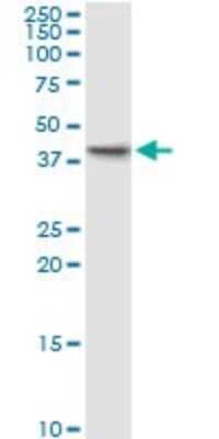 Western Blot: PDCL Antibody (4G5) [H00005082-M03]