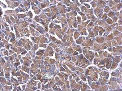 Immunohistochemistry-Paraffin: PDCL Antibody [NBP1-32523]