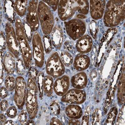 Immunohistochemistry-Paraffin: PDCL Antibody [NBP1-85078]