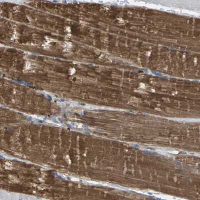 Immunohistochemistry-Paraffin: PDCL Antibody [NBP1-85079]