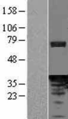 Western Blot: PDCL Overexpression Lysate [NBL1-14210]