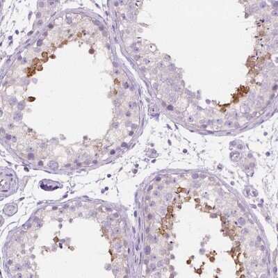 Immunohistochemistry-Paraffin: PDCL2 Antibody [NBP2-13744]