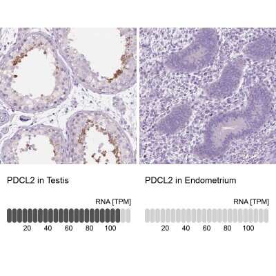 Immunohistochemistry-Paraffin: PDCL2 Antibody [NBP2-13744]