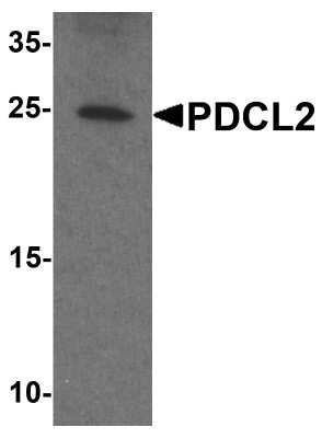 Western Blot: PDCL2 AntibodyBSA Free [NBP2-81765]