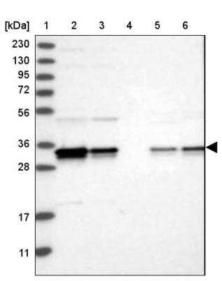 Western Blot: PDCL3 Antibody [NBP1-80626]