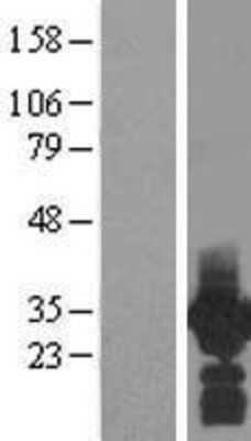 Western Blot: PDCL3 Overexpression Lysate [NBL1-14212]