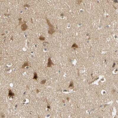 Immunohistochemistry-Paraffin: PDDC1 Antibody [NBP1-93843]