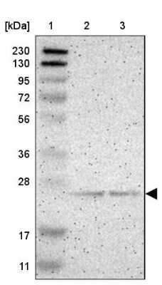 Western Blot: PDDC1 Antibody [NBP1-93843]