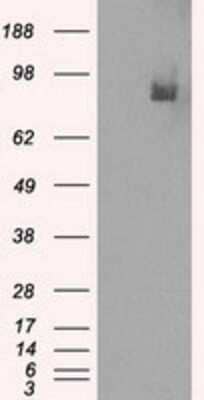 Western Blot: PDE10A Antibody (OTI1C9) [NBP1-47909]