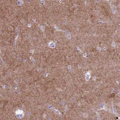 Immunohistochemistry-Paraffin: PDE10A Antibody [NBP2-48869]