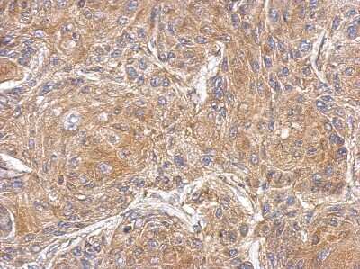 Immunohistochemistry-Paraffin: PDE10A Antibody [NBP2-19742]