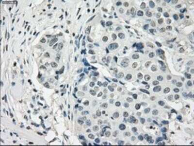 Immunohistochemistry: PDE10A Antibody (OTI1C9) - Azide and BSA Free [NBP2-73273]