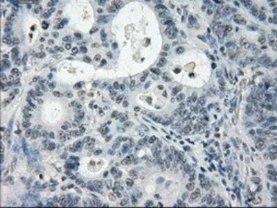 Immunohistochemistry: PDE10A Antibody (OTI1C9) - Azide and BSA Free [NBP2-73273]