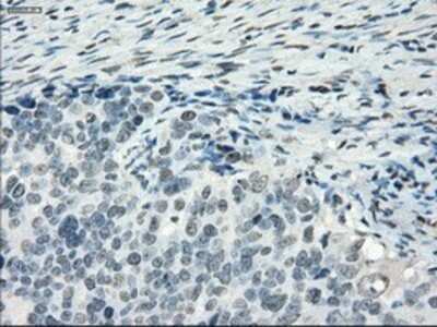 Immunohistochemistry: PDE10A Antibody (OTI1C9) - Azide and BSA Free [NBP2-73273]