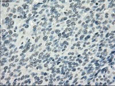 Immunohistochemistry: PDE10A Antibody (OTI1C9) - Azide and BSA Free [NBP2-73273]