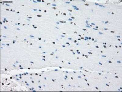 Immunohistochemistry: PDE10A Antibody (OTI1C9) - Azide and BSA Free [NBP2-73273]