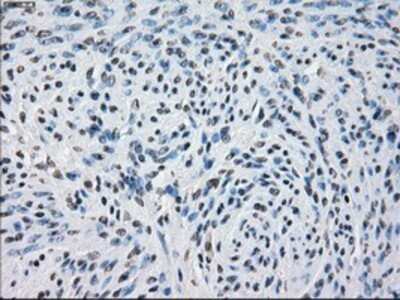 Immunohistochemistry: PDE10A Antibody (OTI1C9) - Azide and BSA Free [NBP2-73273]