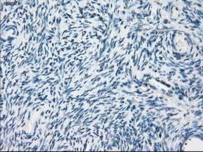 Immunohistochemistry: PDE10A Antibody (OTI1C9) - Azide and BSA Free [NBP2-73273]