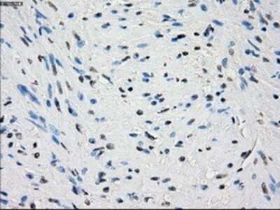 Immunohistochemistry: PDE10A Antibody (OTI1C9) - Azide and BSA Free [NBP2-73273]