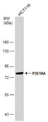 Western Blot: PDE10A Antibody [NBP2-19742]