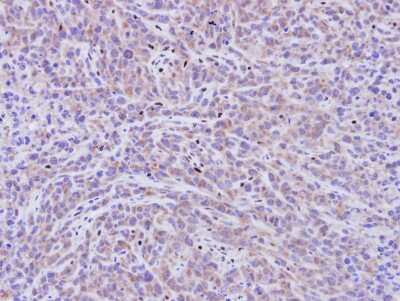 Immunohistochemistry-Paraffin: PDE11A Antibody [NBP1-32910]
