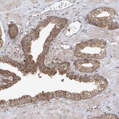 Immunohistochemistry-Paraffin: PDE11A Antibody [NBP1-85919]