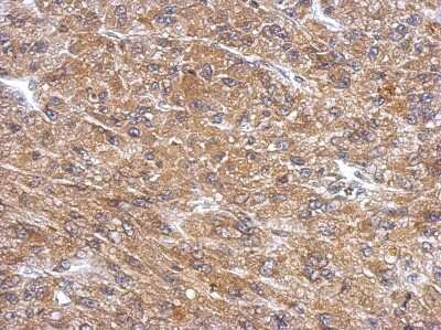 Immunohistochemistry-Paraffin: PDE11A Antibody [NBP2-19743]