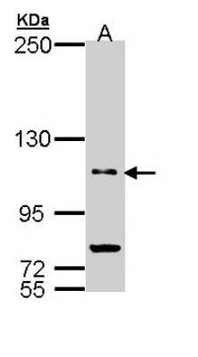 Western Blot: PDE11A Antibody [NBP1-32910]