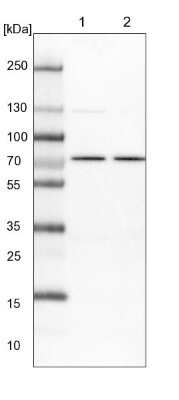 Western Blot: PDE11A Antibody [NBP1-85919]