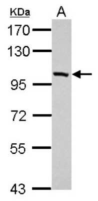 Western Blot: PDE11A Antibody [NBP2-19743]