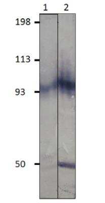 Western Blot: PDE11A Antibody [NBP3-12240]