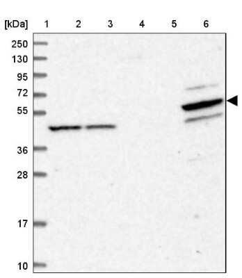 Western Blot: PDE12 Antibody [NBP1-89381]