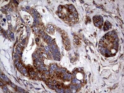Immunohistochemistry: PDE1A Antibody (OTI7D5) [NBP2-46355]