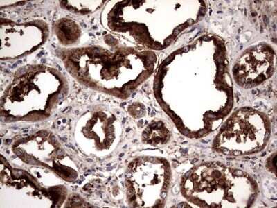 Immunohistochemistry: PDE1A Antibody (OTI7D5) [NBP2-46355]